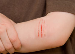 cat scratch fenbendazole panacur online